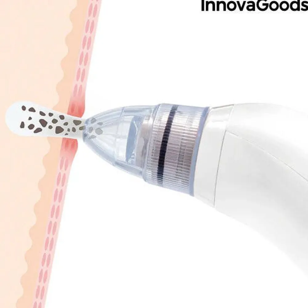 InnovaGoods Kauneus Ja Terveys|mustapäiden poistaja